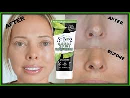 ST Ives Blackhead clearing scrub /කලු ලප නැති කරන ස්ක්‍රබ්